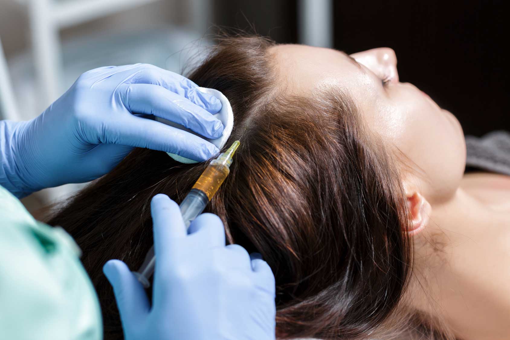 проведение мезотерапии от выпадения волос