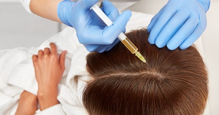 Мезотерапия для волос – что это такое и поможет ли остановить выпадение?